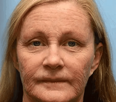 💎KJØP 1, FÅ 1 GRATIS💎Retinol-ansiktsserum med oppstrammende effekt