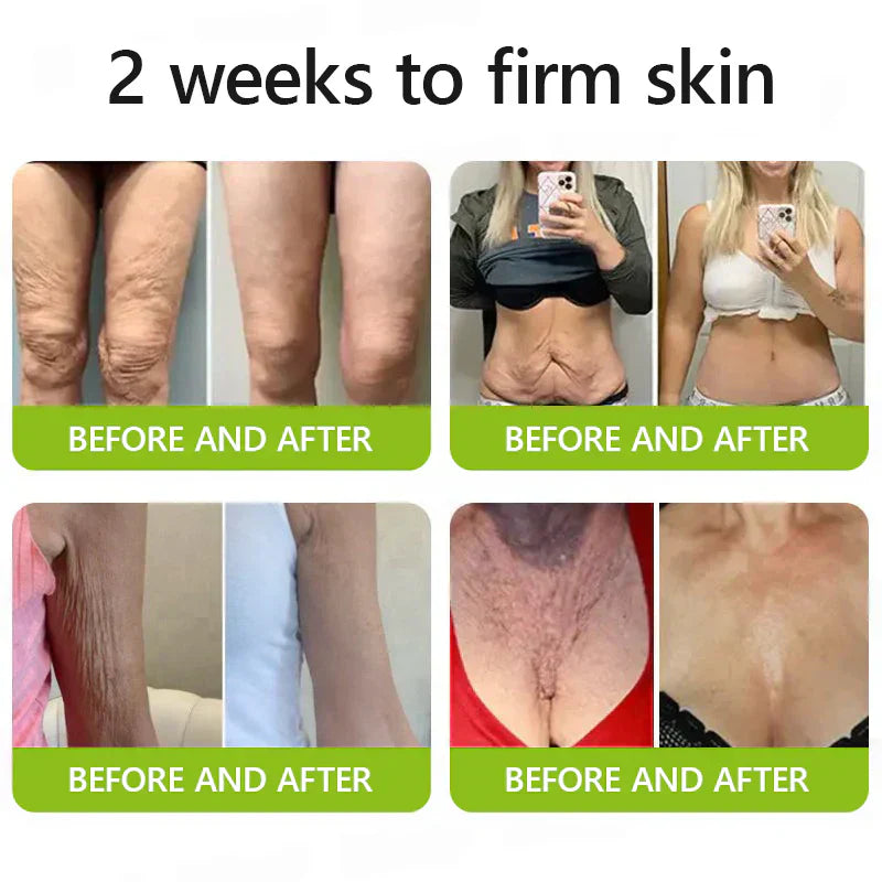 💎KJØP 1, FÅ 1 GRATIS💎Retinol-ansiktsserum med oppstrammende effekt